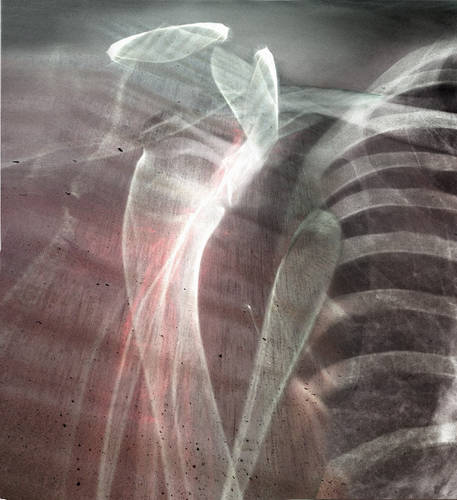 Alien Shoulder X-Ray